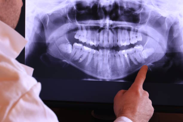 Best Emergency Treatment for Toothache in Westbrook Center, CT